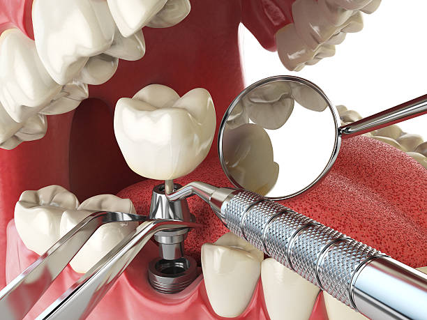 Best Weekend Emergency Dental Services in Charenton, LA